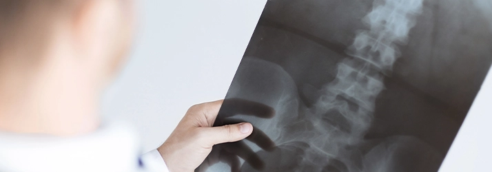 Chiropractic Carrollton TX Digital X-Rays A person holding an x-ray.